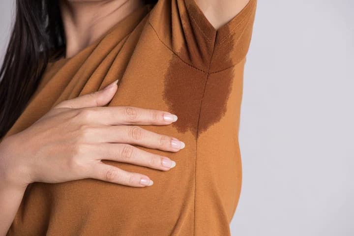 Excessive Sweating (Hyperhidrosis)