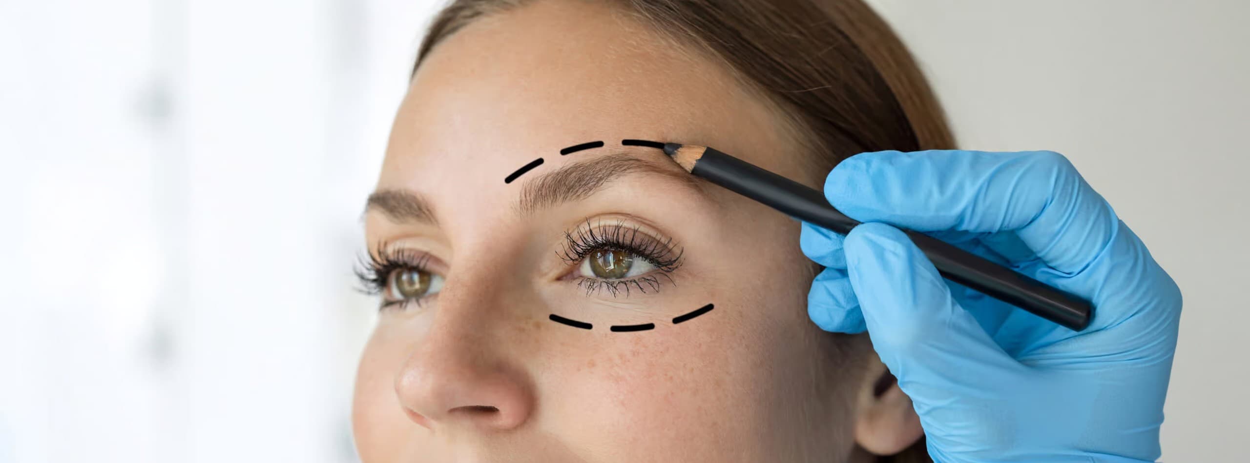 Brow Lift treatment area