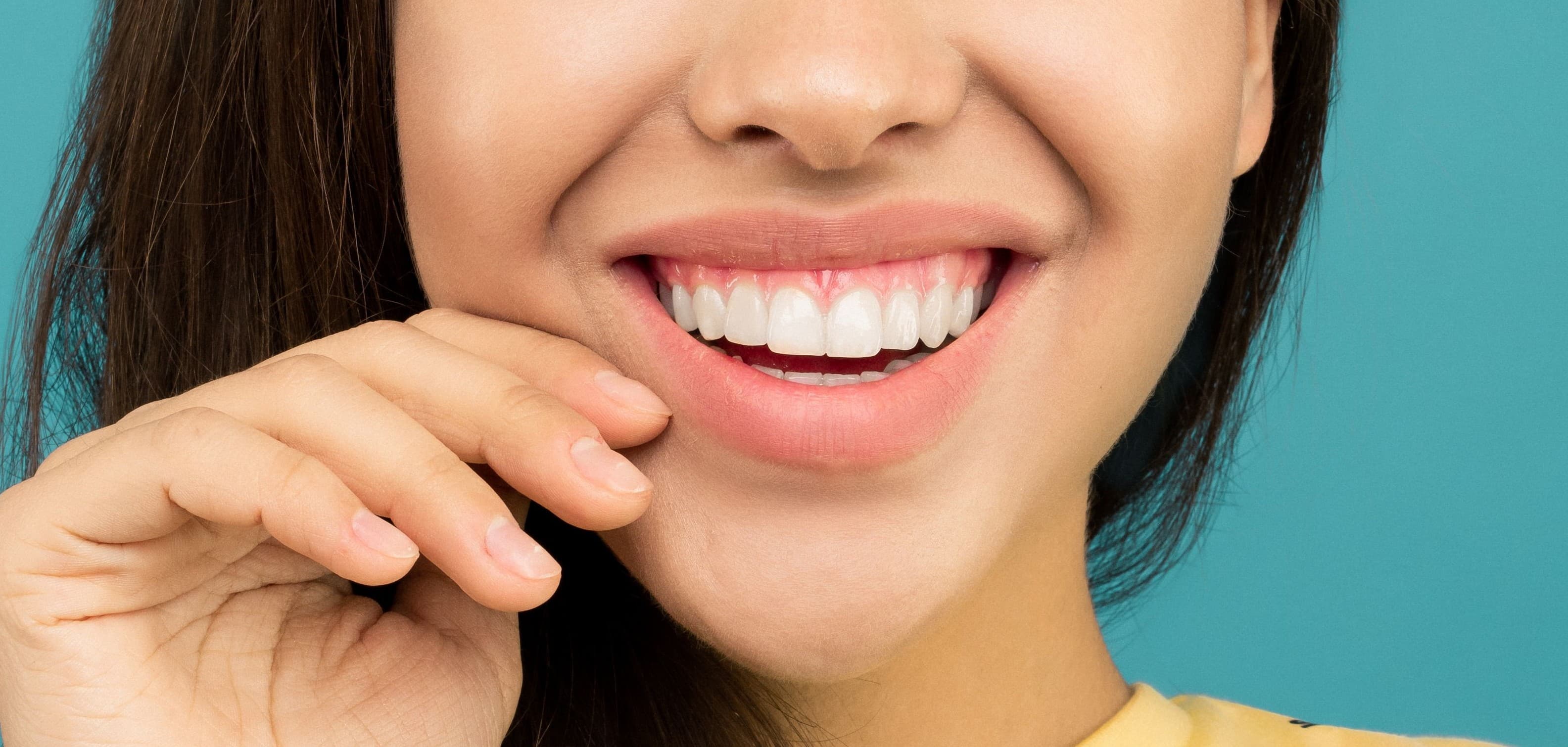 Gummy Smile treatment area