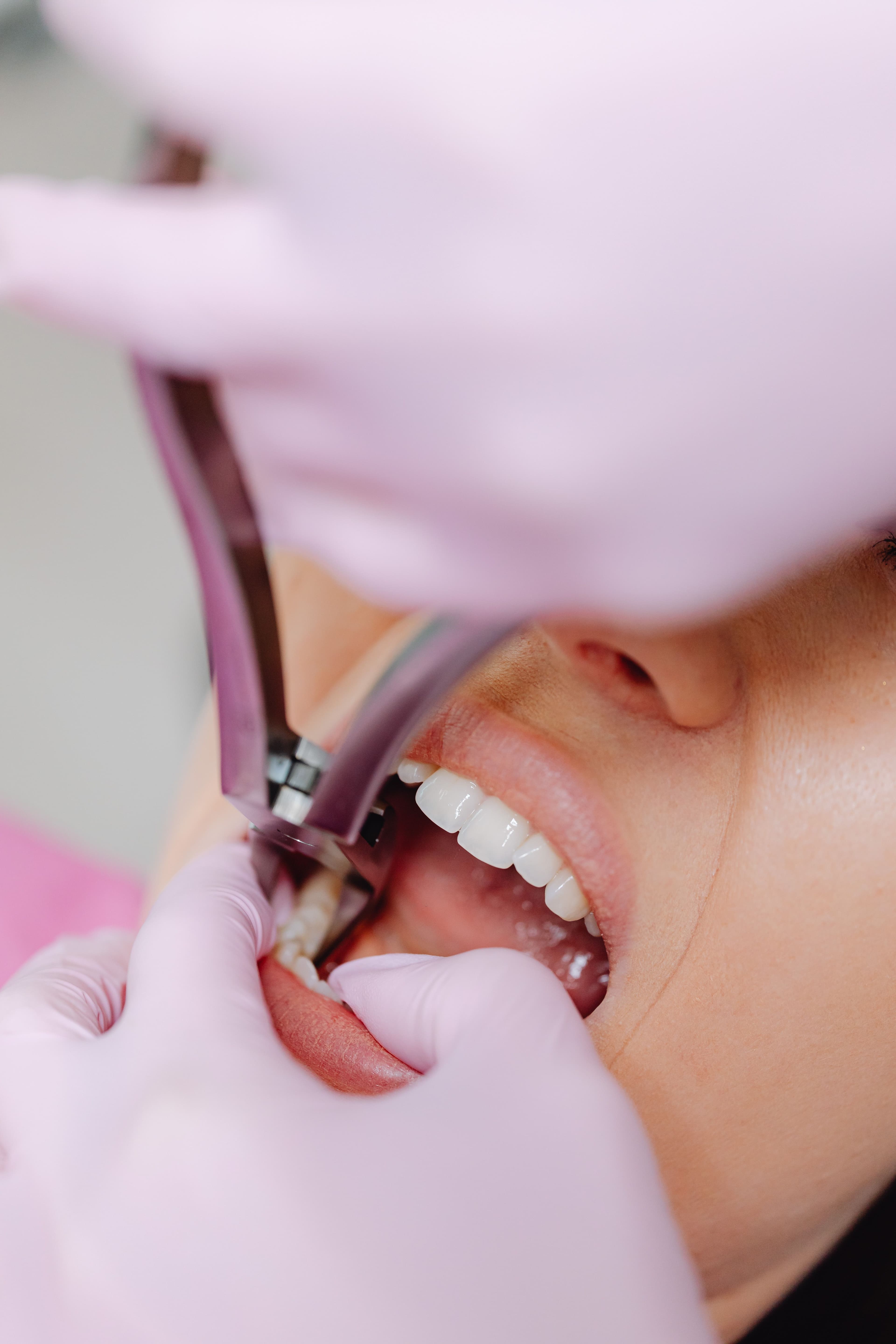 Emergency Dentistry